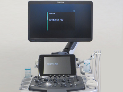 宮﨑クリニック 超音波肝硬度測定（